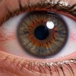 Qué hay que hacer para curar la conjuntivitis: este es el tratamiento