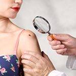 Melanoma en Colombia: casos previstos en jornadas gratuitas / Getty Images
