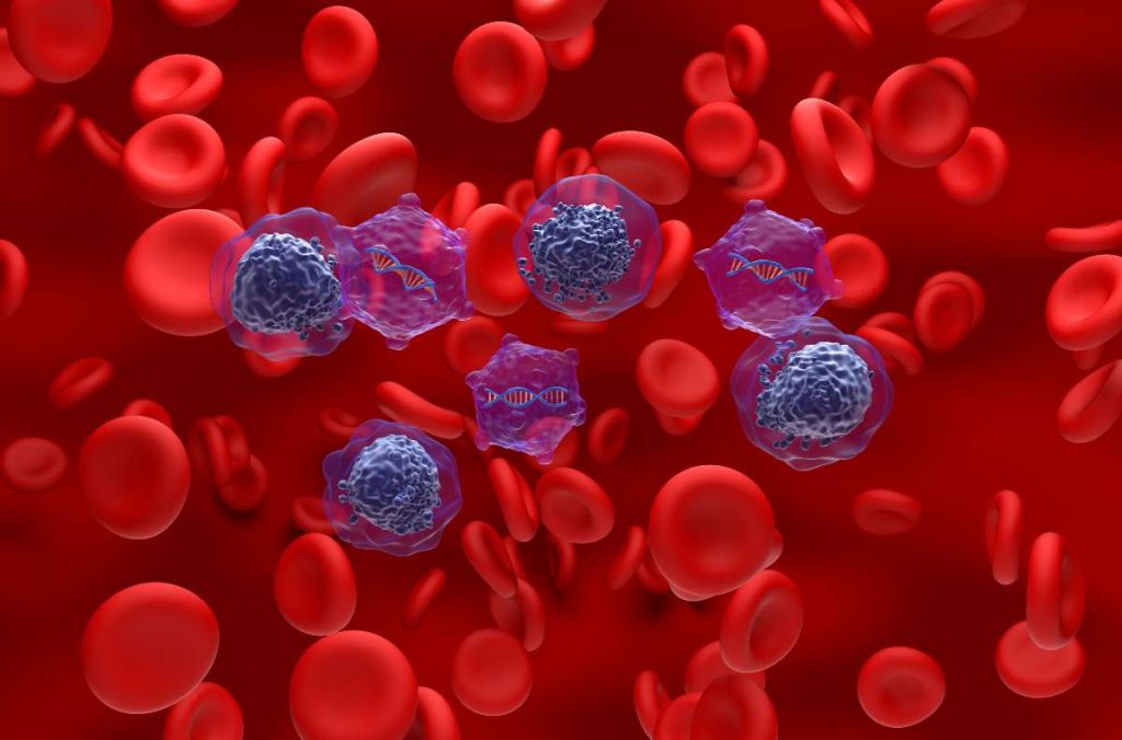 Leucemia mieloide aguda: qué es y primera de más casos anuales / Getty Images