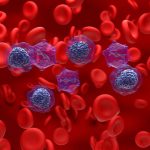 Leucemia mieloide aguda: qué es y primera de más casos anuales / Getty Images