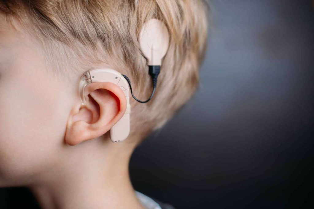 Pérdida auditiva: Bogotá estrena centro especial en América Latina / Cortesía Cochlear
