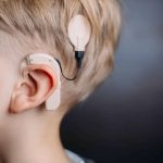 Pérdida auditiva: Bogotá estrena centro especial en América Latina / Cortesía Cochlear