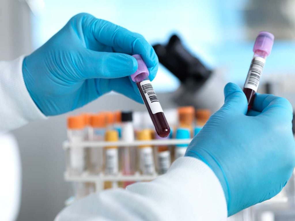 Errores de laboratorio pueden surgir antes del análisis en un 60 % / Getty Images