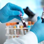 Errores de laboratorio pueden surgir antes del análisis en un 60 % / Getty Images