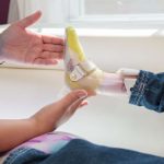 Prótesis para niña que perdió sus piernas tras amputación en 2026 / Getty Images