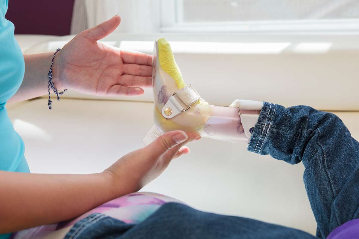 Prótesis para niña que perdió sus piernas tras amputación en 2026 / Getty Images